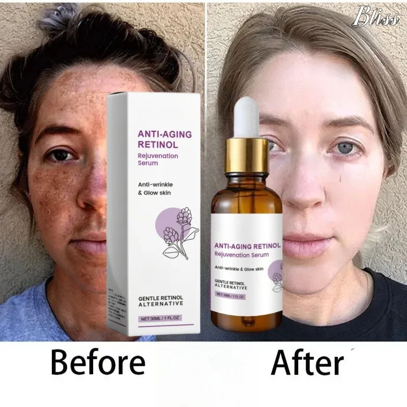 30ml Retinol Serum Brightening Face Essence Dispel Dark Spots Removal Melasma Bleach Emulsion Improve Dullness Facial Skin Care