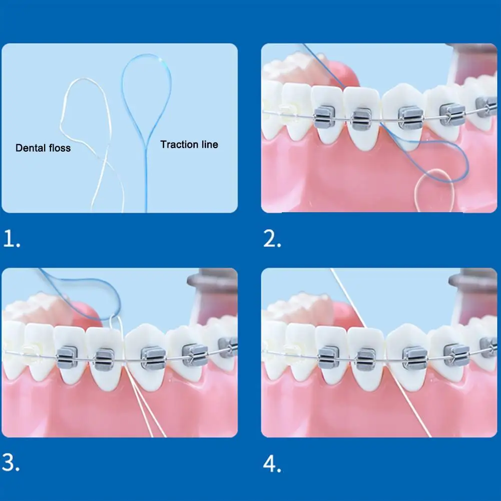 Enfileur de fil dentaire, support de fil dentaire entre les bretelles orthodontiques, bretelles de traction de pont