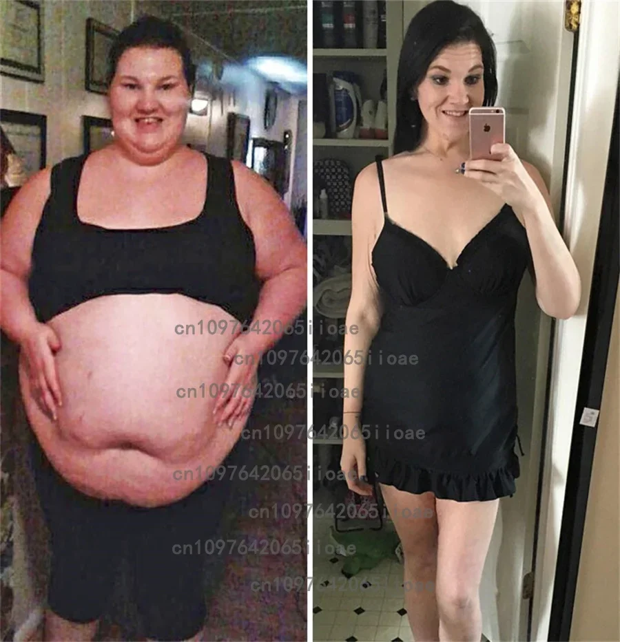 30 Patches Fat Burner Raspberry Ketones Detox Slimming Belly Promotes Metabolism and Fat Burning Transdermal Patches
