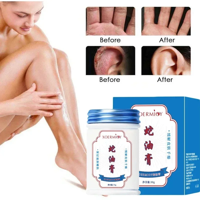 Herbal Anti-Crack Foot Cream, Evita Frostbite, Hidrata a pele, Remove a pele morta, Suaviza, Cuidados com a pele