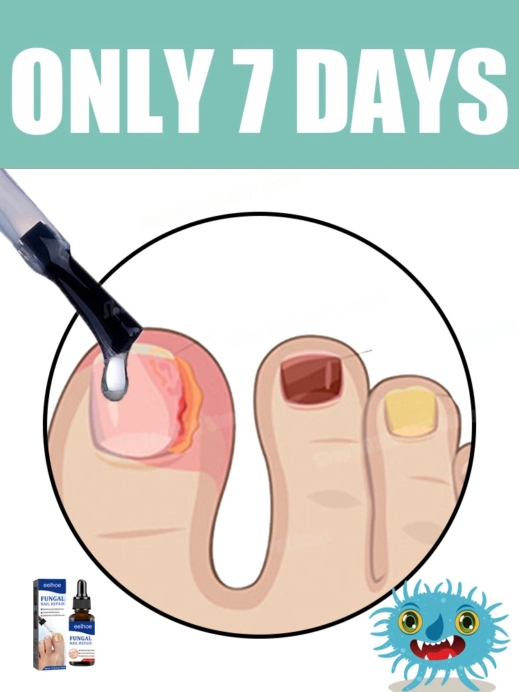 Ringiovanitore - Tecnologia di prevenzione dei funghi - Controllo e sensore di sicurezza regolabili Hot102