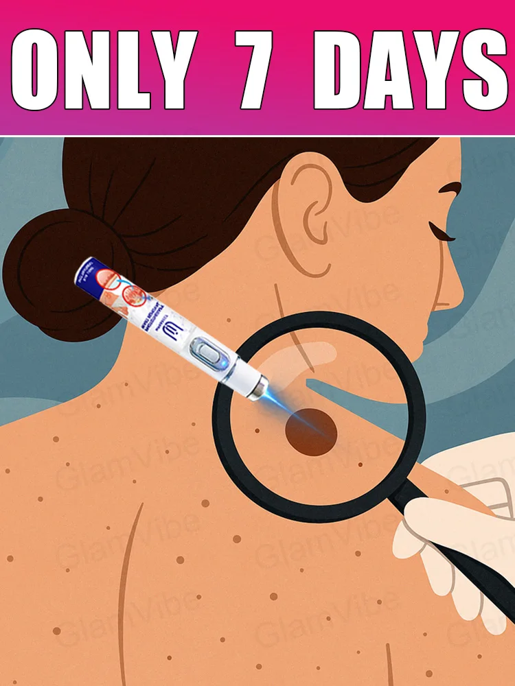 

blue light pen solve warts, hot sale wart care tools