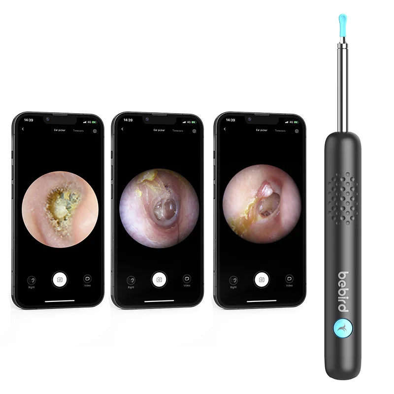 

Bebird newest model R1 smart pro ear 3 in 1 endoscope 3.9mm ear wax remover ear cleaning machine