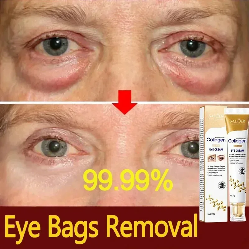 Crème anti-déformable au collagène pour les yeux, action rapide, raffermissante, estompe les ridules, élimine les poches sous les yeux, éclaircit les soins oculaires