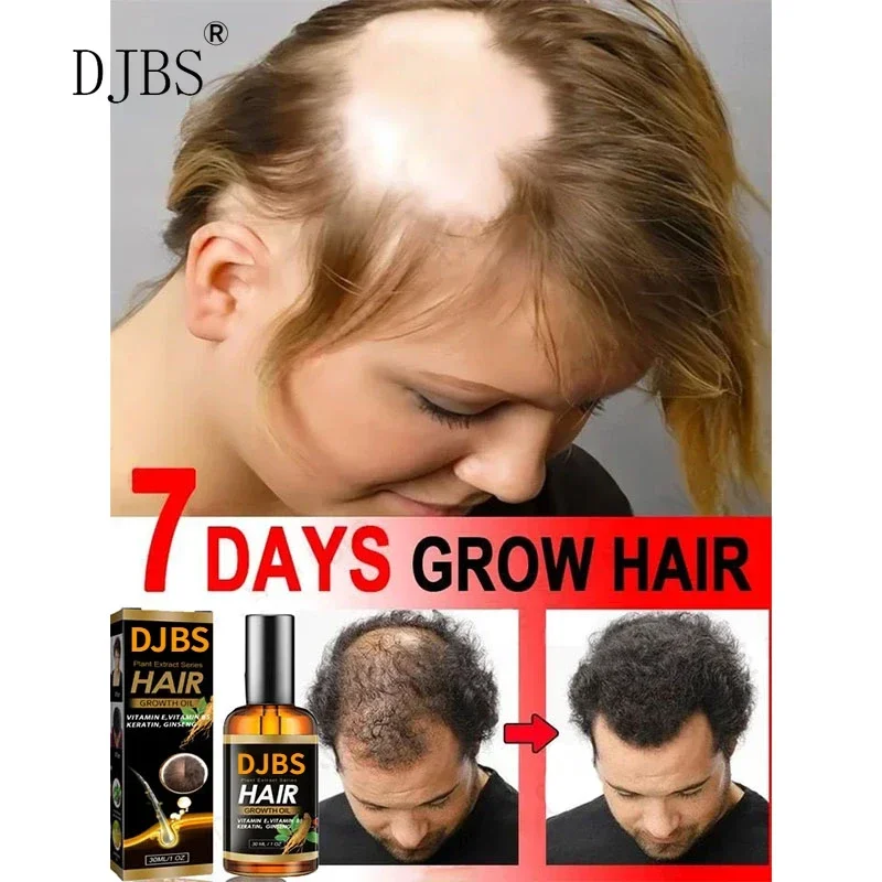 

DJBS Unisex Hair Growth Oil Hair Loss Treatment Rapid Hair Growth Effective Baldness Repair Hereditary Postpartum