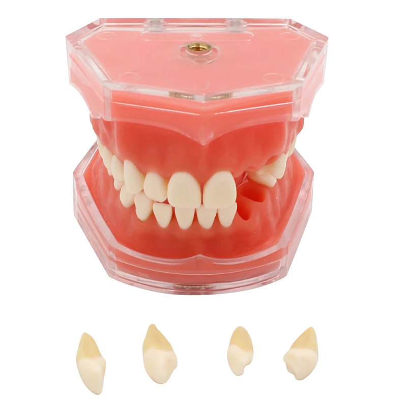 All Teeth Detachable Normal Teeth Model Dental Model For Dentist Student Oral Medical Demonstration Module Teaching Tools