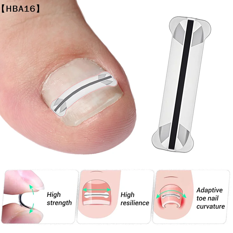 maveraHBA16 Adesivos de Correction d'ongle incarné Patchs correcteur d'ongle Invisible Patch auxiliaire haute résistance Traitement de Paronychia