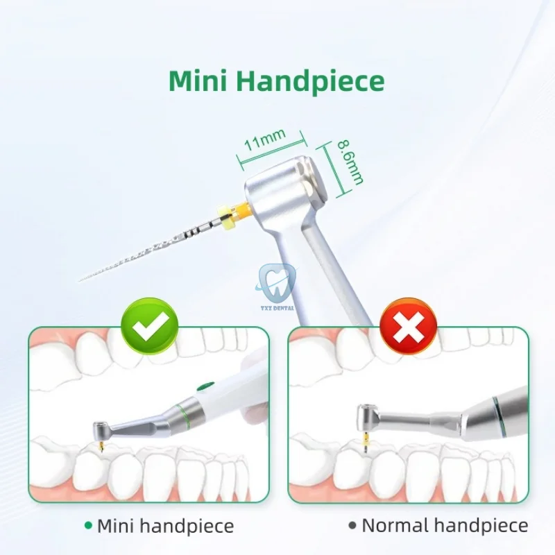 محرك لبي الأسنان لاسلكي مع شاشة LCD ، علاج قناة الجذر ، معدات عيادة طب الأسنان ، زاوية كونترا