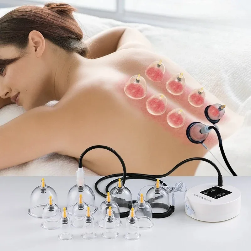 Elektrisches Vakuum-Schröpfmassagegerät mit 6/12 Tassen Saugheizfunktion zum Abnehmen des Körpers, Anti-Cellulite-Muskelschmerzlinderung