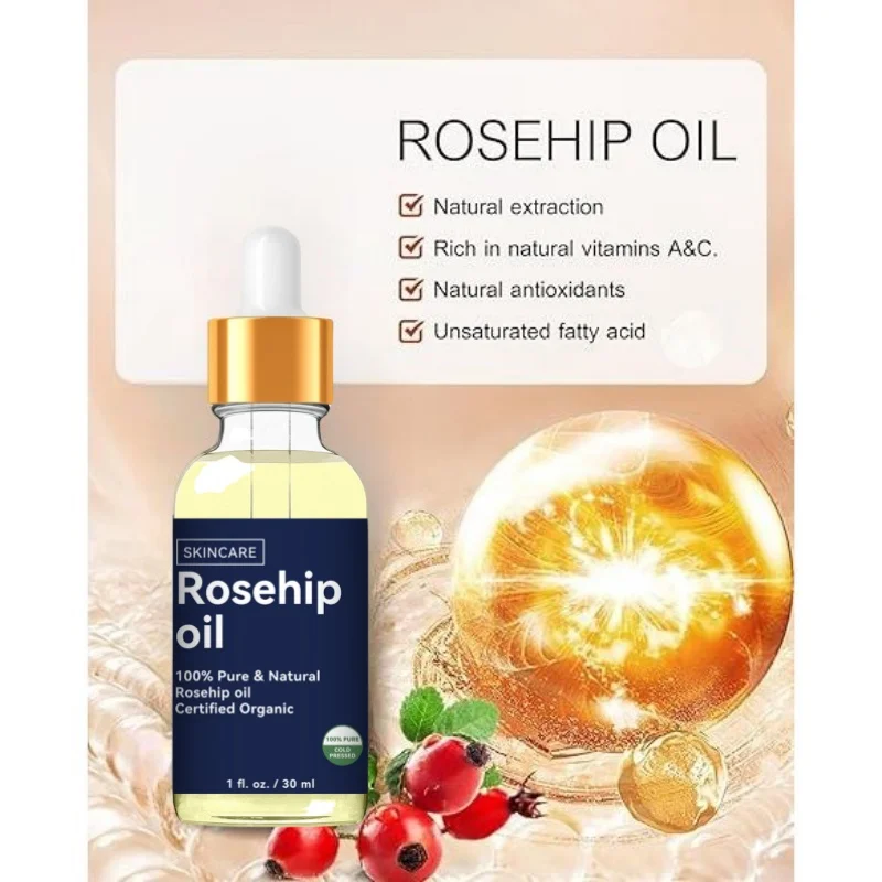 Rozenbottelolie Zorg Voor Gezond Haar 100% Pure & Natuurlijke Rozenbottelolie Gecertificeerd Biologisch 100% Puur Koudgeperst 1 Fl. Oz./30 Ml