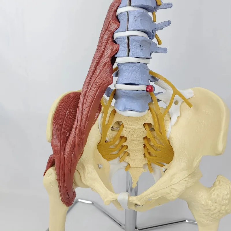 A 1:1 Spinal Model Of The Human Body Color Discrimination Detachable Pelvic Intervertebral Disc With Neuromedical