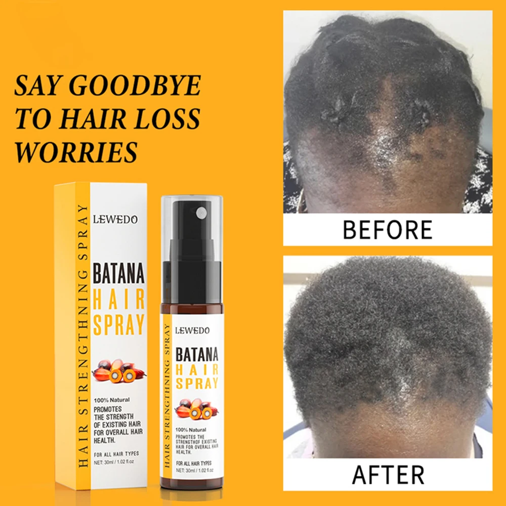 

1/2pcs Batana Oil Anti-hair Loss Spray Hair Care Essence Break Black Hair Regrowth Treatment for Hair Care and Hair Growth Spray