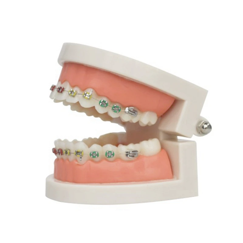 Orthodontic Treatment Teeth Model With Bracket Arch Wire Buccal Tube Ligature Ties Dentist Model Teaching Tools