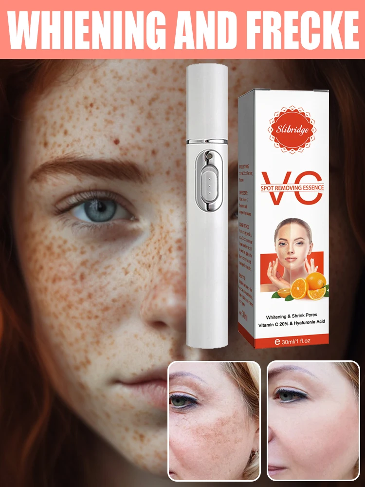 Black Spot VC Removal Melasma Dark Spots Corrector Lighten Melanin Pigmentation Brighten Anti-Aging