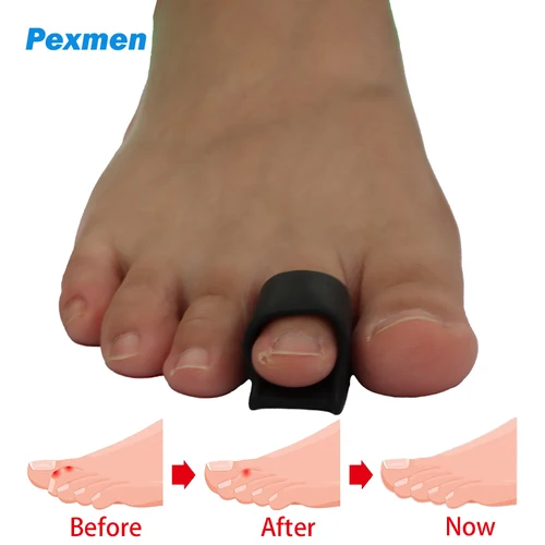 Pexmen 2/4 Uds Corrector de punta de martillo alisador de punta de martillo para garra doblada torcida y dedos superpuestos almohadillas para juanetes