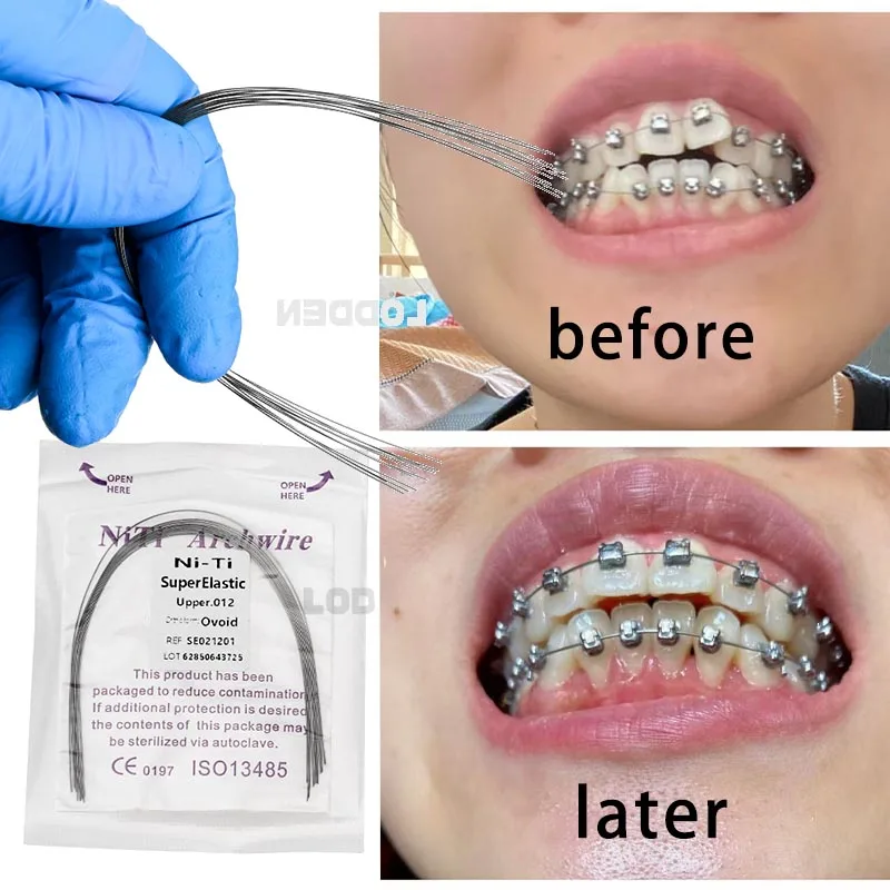 

50 шт./5 упаковок, стоматологическая ортодонтическая арка Niti, суперэластичная круглая/прямоугольная дуга, проволока, инструмент для стоматолога