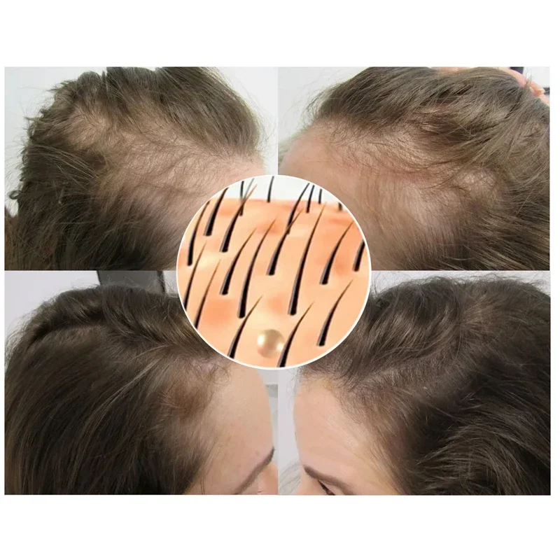 Hair Growth Products Ginger Anti-hair Loss Spray Fast Growing Beauty Hair Care Prevent Hair Loss Oil Scalp Treatment Repair Care