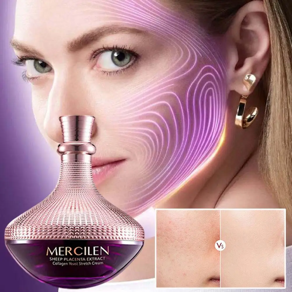 creme-facial-hidratante-de-colageno-de-placenta-de-ovelha-com-levedura-natural-nutritivo-hidratante-para-pele-suave-e-macia-cuidado-diario-para-o-rosto