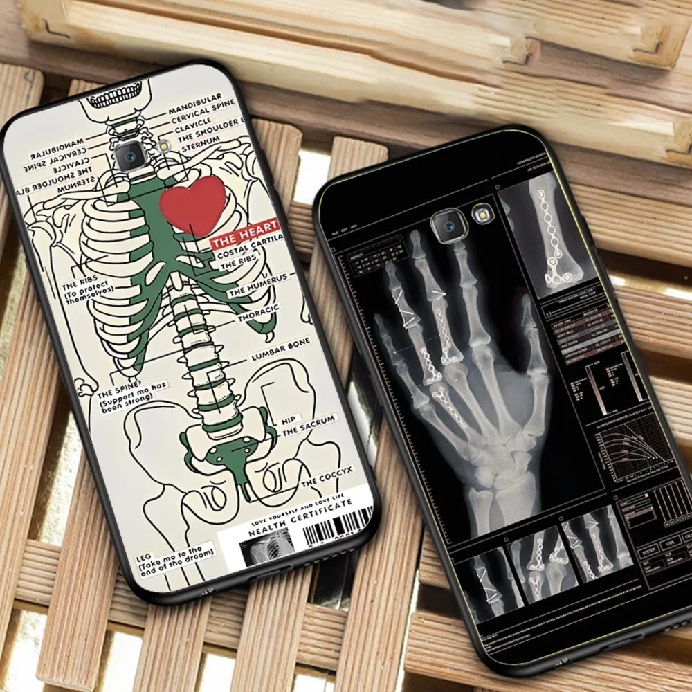 Radiological human organs Skeleton skull Phone Case For Samsung J 7 plus 7core J7 neo J6 plus prime J6 J4 J5 Mobile Cover