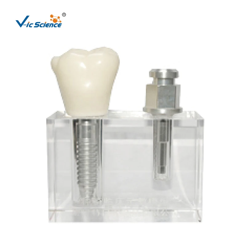 

Transparent Implant Teeth Anatomy Teaching Model