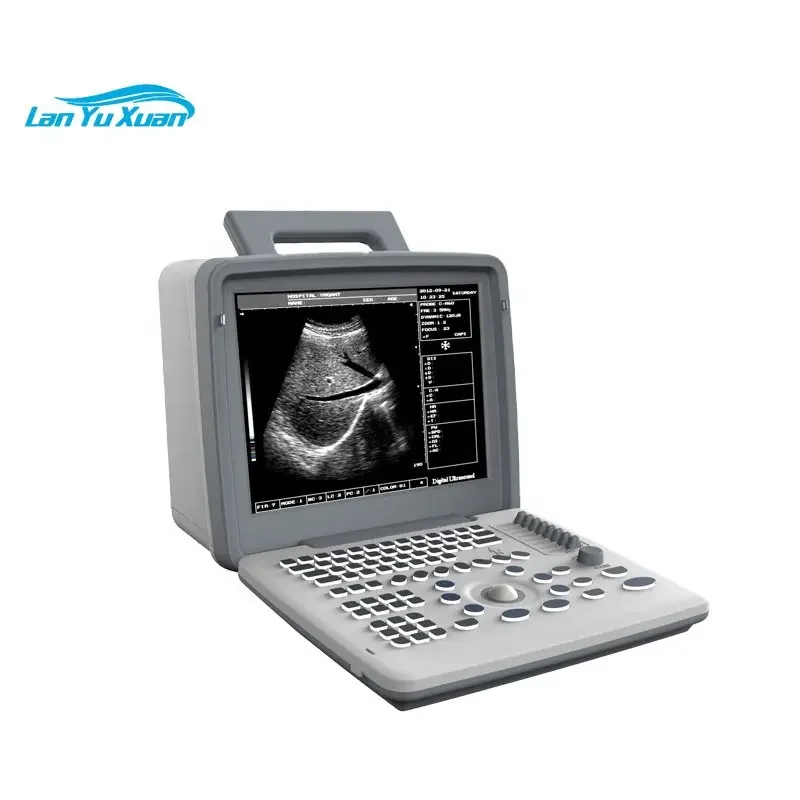 

Hot Selling Clinic Use Cheapest Ultrasound Scan Machine Portable for Sale