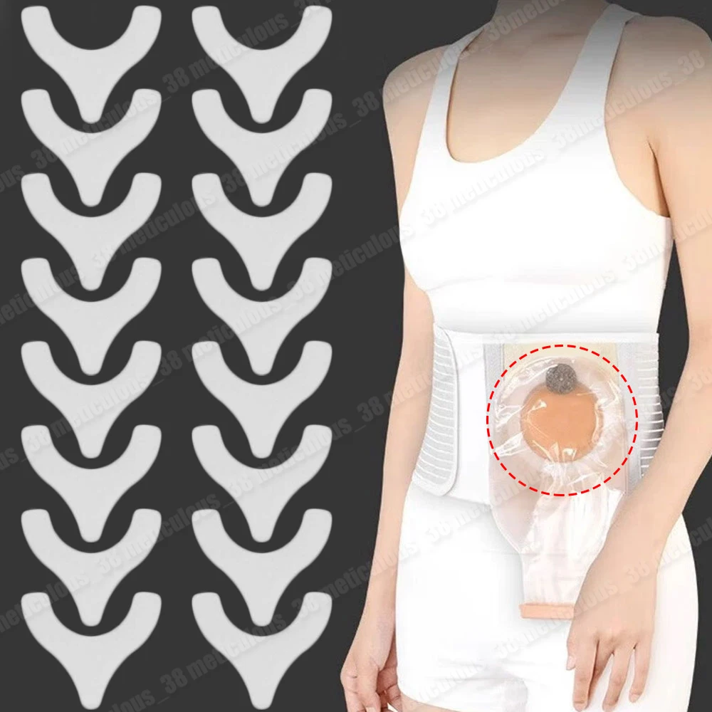 

20-200PCS Ostomy Barrier Strips Y Shape Adhesive Seal Extender Strip for Colostomy Bags Ileostomy Tape for Stoma Ostomy Bag