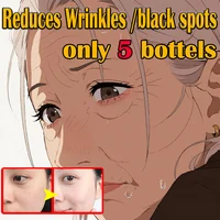 Suero Facial 5 en 1 30% vitamina C hidratante brillo vitamina C ácido hialurónico suero Facial reduce los poros cuidado de la piel