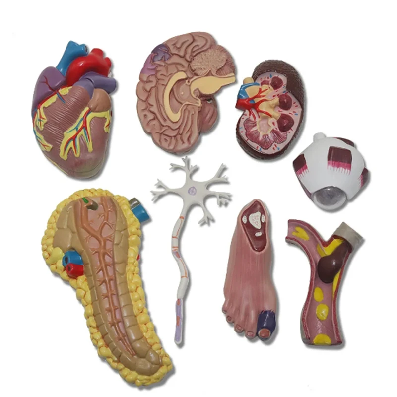 Modelo de órgano humano para la Diabetes, modelo anatómico desmontable, suministros de anatomía médica, herramienta educativa de enseñanza