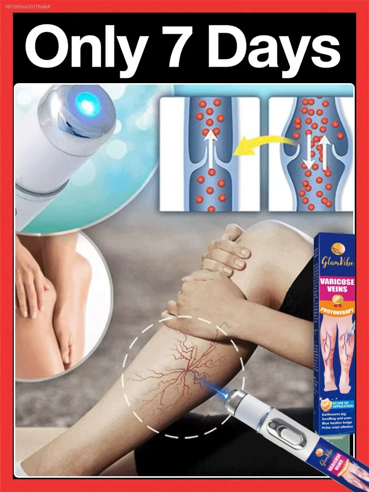 Rectangular and bluish veins on the legs, restoring the aesthetic appearance of the legs.
