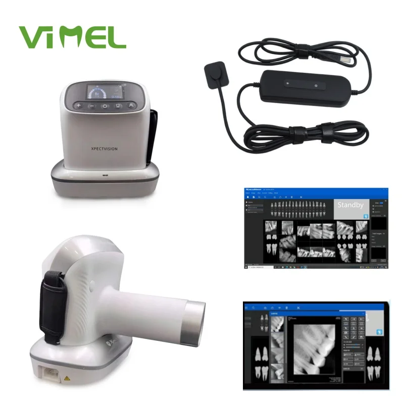 

Original Xpect Vision XVbeam 2000 Handheld Dental x -ray Machine With Sensor High Frequency Xray Image System Dentistry Equipme