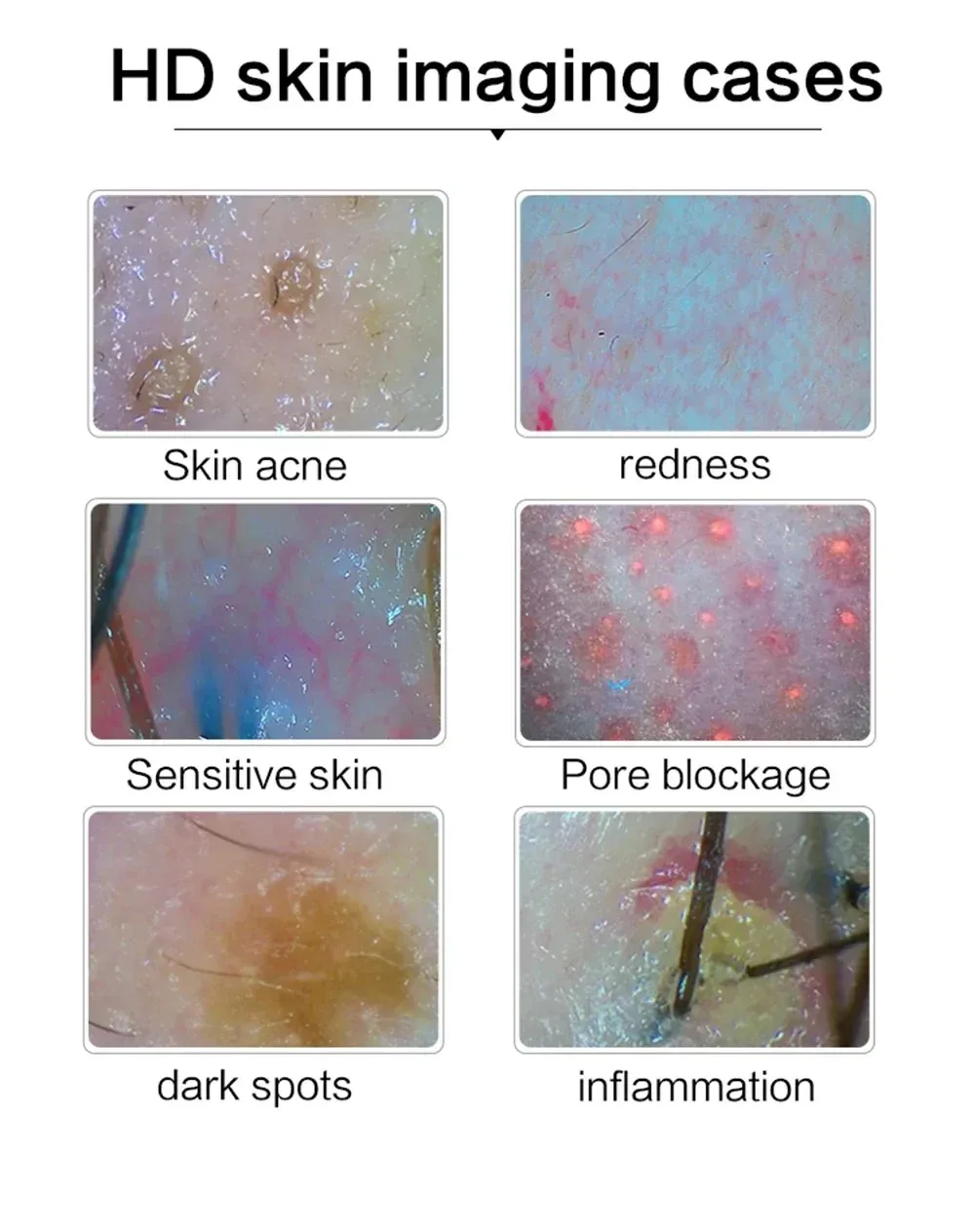 15HD Professional Skin Hair Detector หนังศีรษะรูขุมขน Moisture ผิวรูขุมขน Pigment แว่นขยายเครื่องวิเคราะห์ผิว Pigment Tester