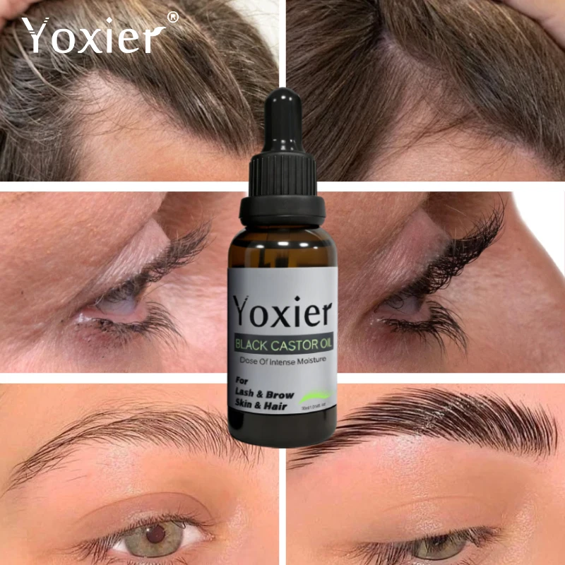 Szybkie serum na porost rzęs, stymulujące wzrost włosów w rzęsach, zapobiegające wypadaniu włosów, zapobiegające łysieniu, dla pełniejszych i grubszych brwi i rzęs.