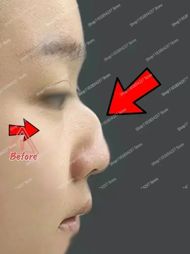 HOT SALE Nose Up Heighten Essence Oil Collagen Firming Lifting Moisturizer Nasal Bone Remodeling Pure Natural Nose Care