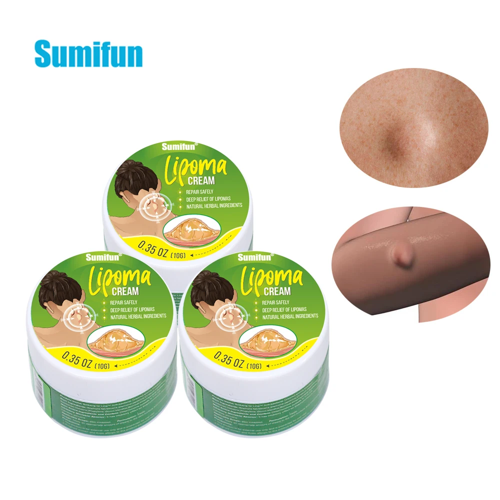 

3Pcs Sumifun Lipoma Removal Ointment Anti-Tumor Peeling Pain Relief Cream Fat Lump Remover Nodular Detox Chinese Medicine