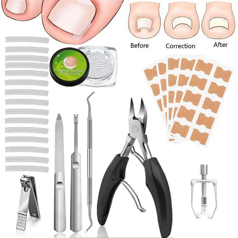 1 Set Adhesive Toenail Patch Ingrown Toe Nail Correction Sticker Foot Corrector Pedicure Healthcare Tools Toe Treatment Pad