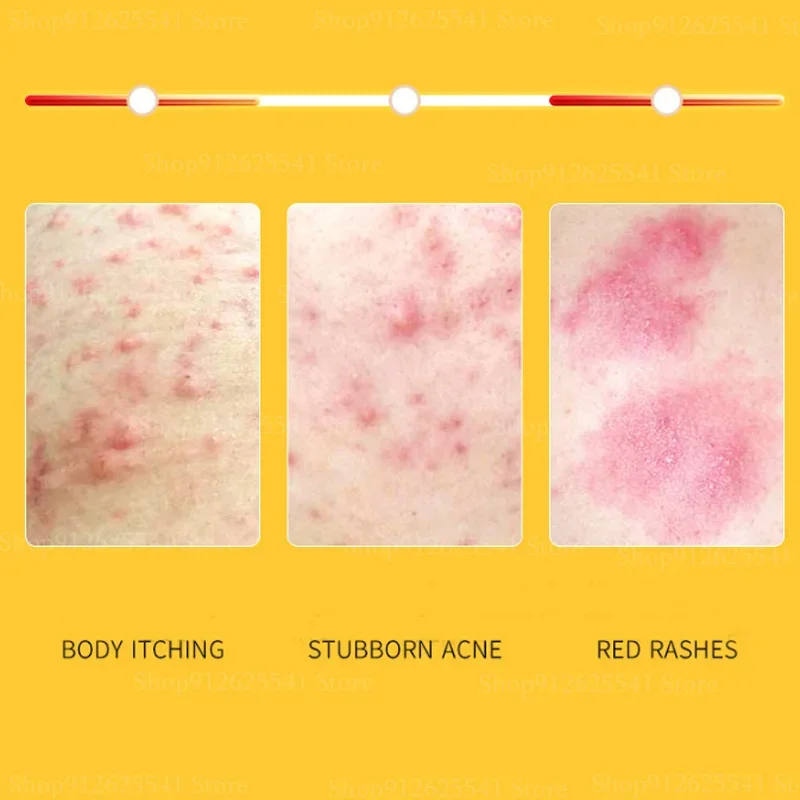 400ml Itching and Sterilization Whitening Body Cream Sulfur Ointment Scabies Mites Fat Bath Sulphur Body Wash Lotion