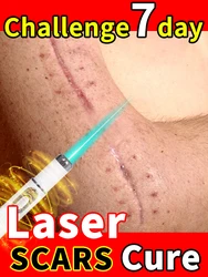 Cicatrice Laser