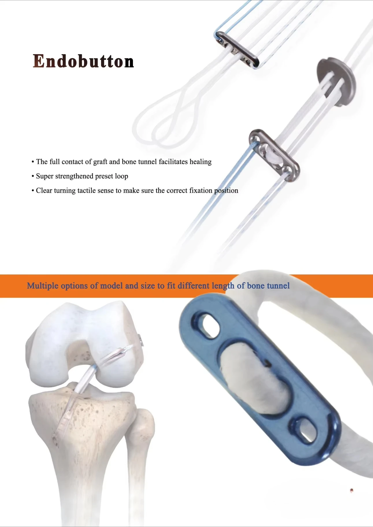 Arthroscopic Knee Reconstruction with Titanium Incision Button with Ring Instrument