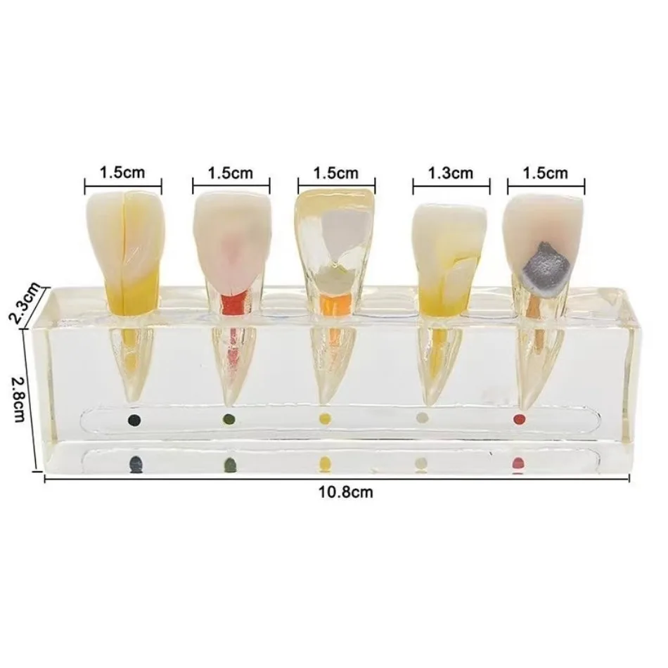 

Dental Materials Front Teeth Root Canal Practice Demonstration Model Crystal 5 Front Teeth Model Oral Model Teeth Model