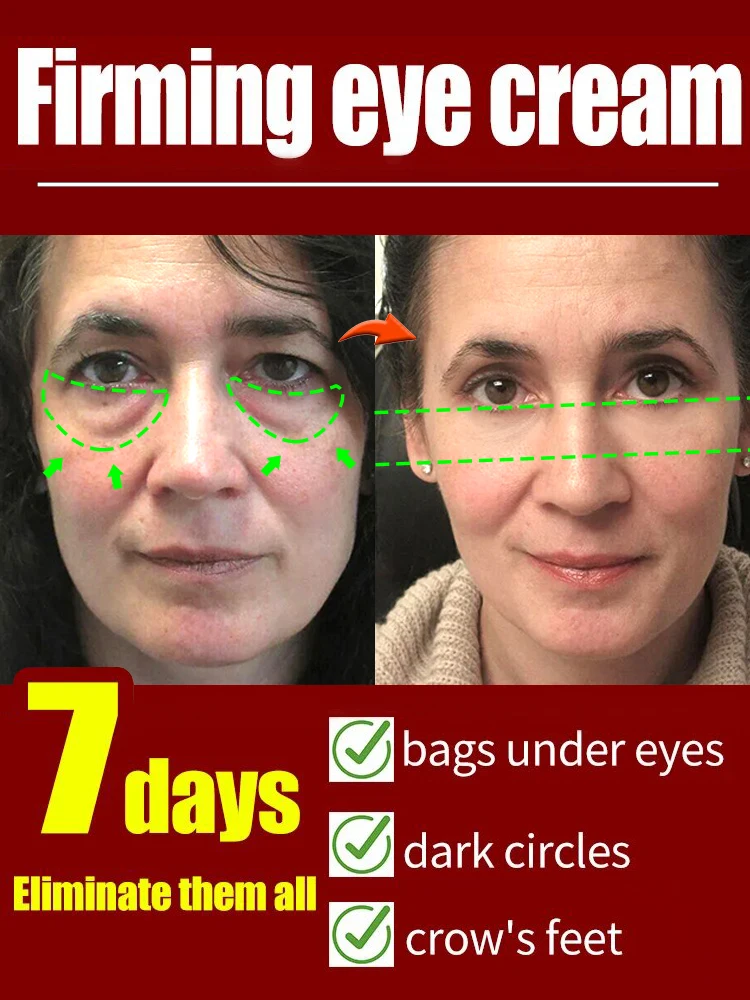 Repair eye problems