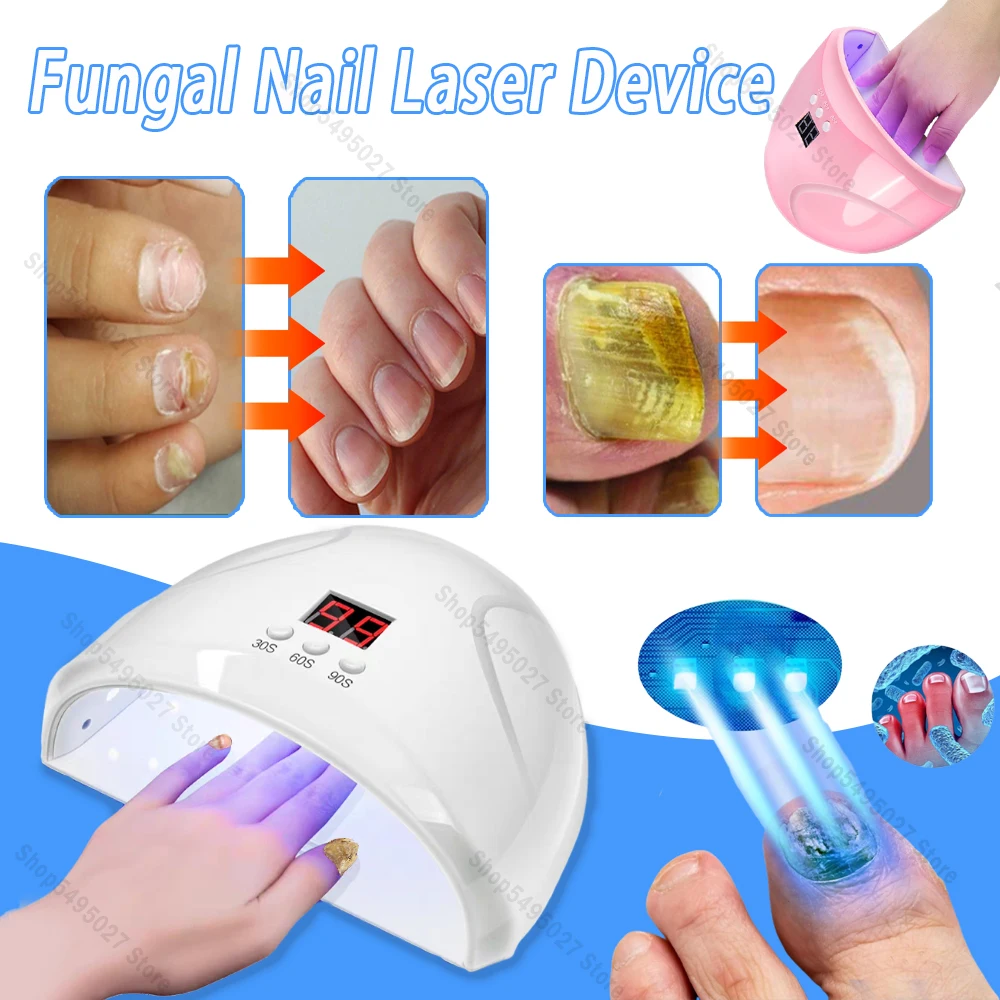 

Toenail Fungal Nail Laser Treatment Repair Fast Nails Fungus Onychomycosis Repair Removes Foot Fingernail Nail Fungus Device