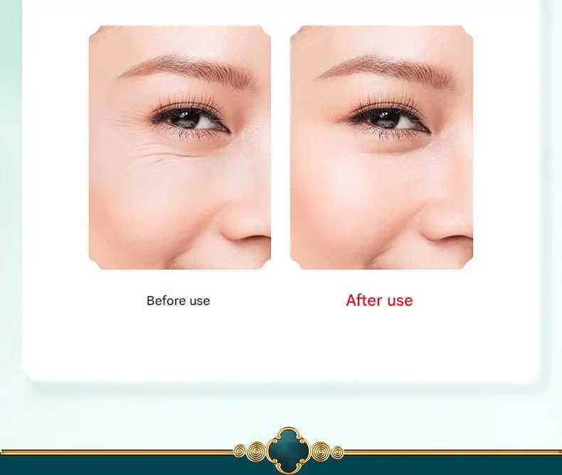 Thumbnail 4 - #41 Best Eye Massage Instruments to Buy In 2026