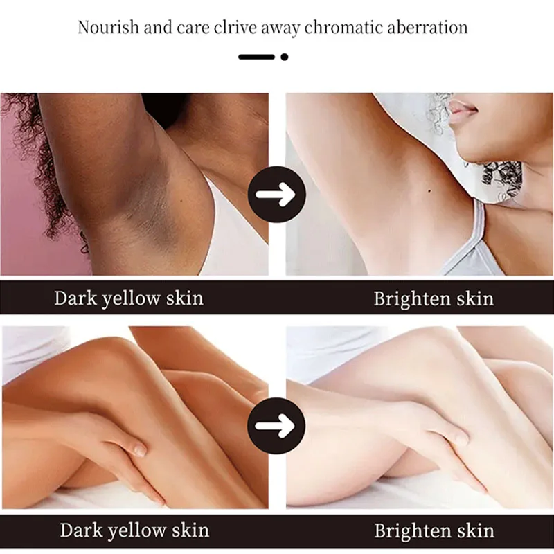 Body Whitening Cream Underarm Knee Buttocks Private Parts Bleach Remove Melanin Dull Inner Thighs Dark Skin Brighten Skin Care