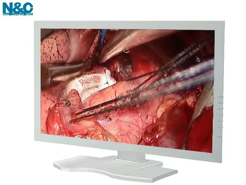 

24 Inch Medical Grade Full HD Endoscope Monitor for Ent