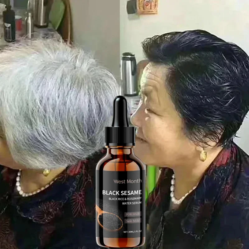 

Gray White Hair Treatment Serum White To Black Repair Natural Color Black Rice Nourish Essence Anti Hair Loss Anti-gray Products