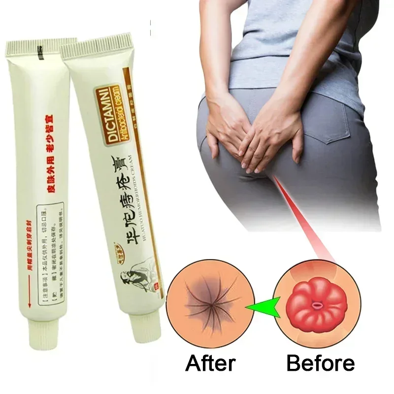 Herbal Hemorrhoids Cream Internal Hemorrhoids Piles External Anal Fissure Treatment Body Skin Care Day Cream Drop shipping