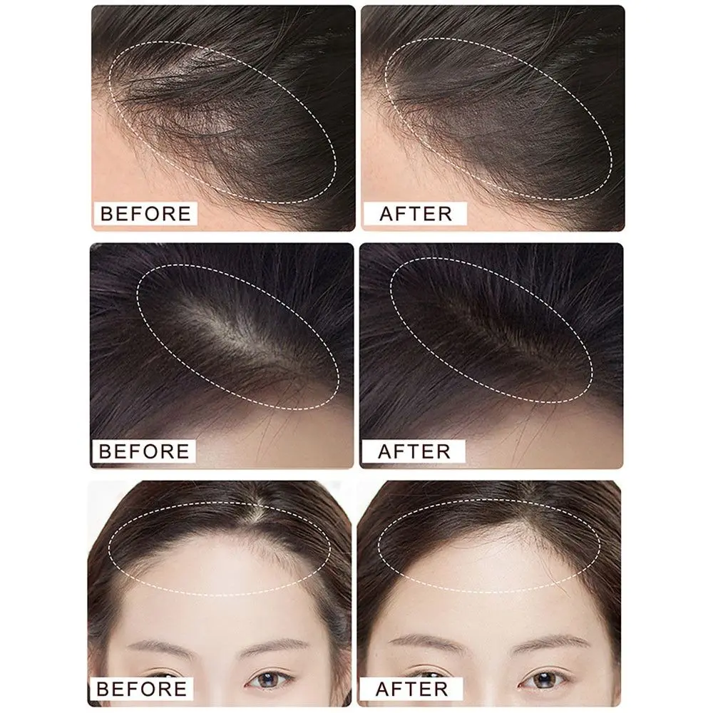 Unisex Hair Concealer Bald Coverage Hairline Powder Hairline Shadow Forehead Trimming Hair Filling