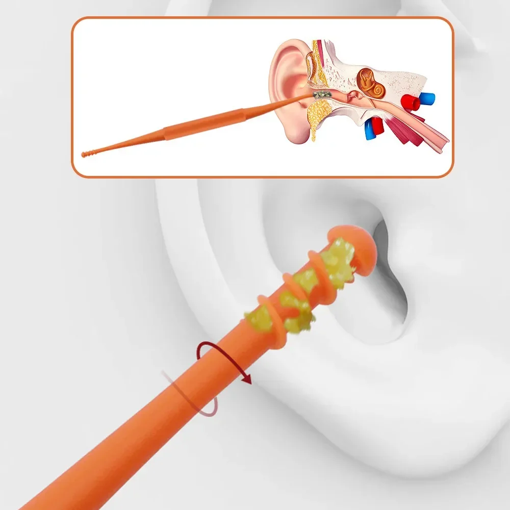 

1 набор палочек для чистки ушей, инструмент для удаления ушного воска, инструмент для удаления ушных палочек, силиконовая черная оранжевая палочка для ушей, двухсторонний очиститель ушей, спиральная палочка на 360 °
