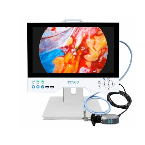 All In One Righid Multi Flexible Endoscopy Camera Full HD Light Source Endoscope Record System For Laparoscopy Uroscopy ENT