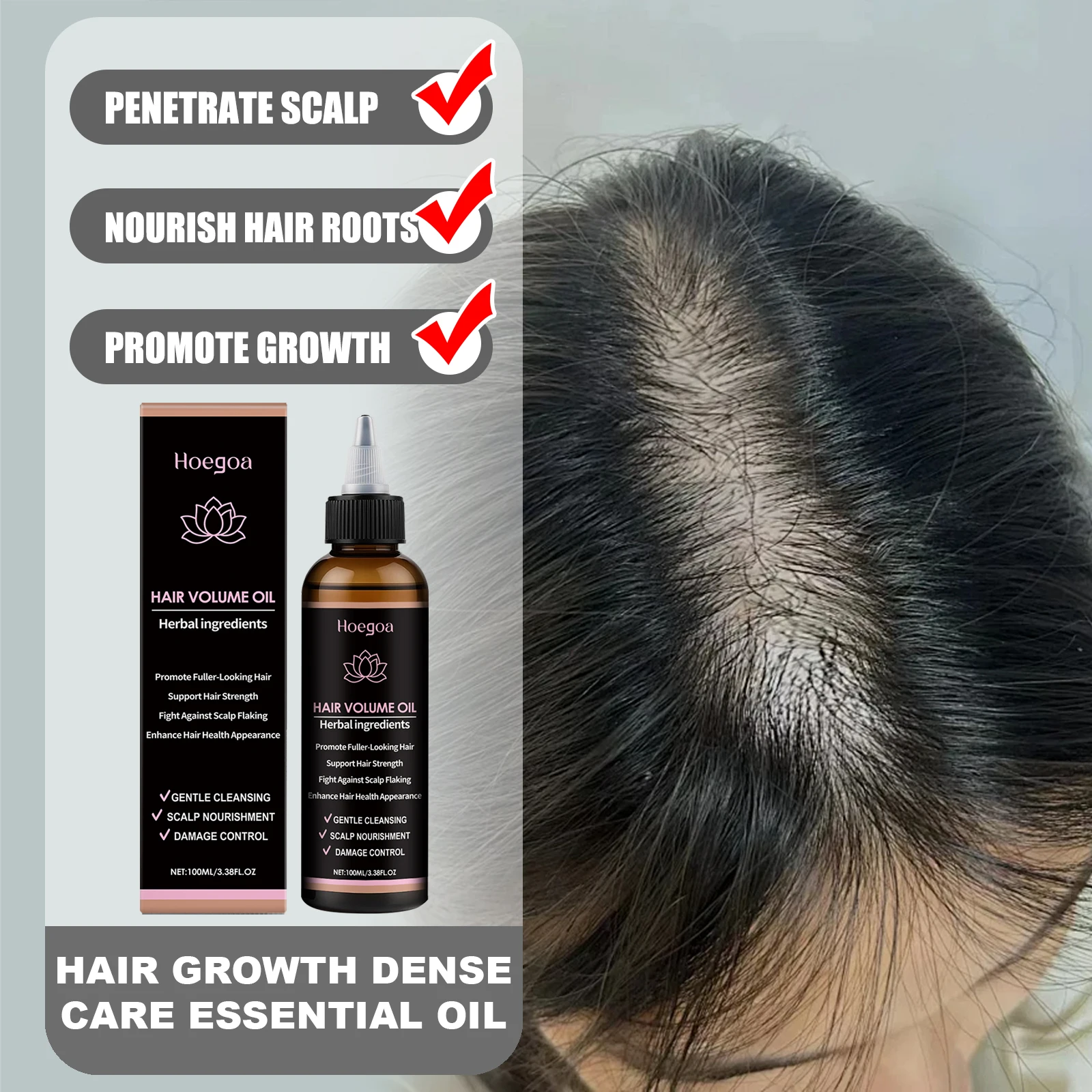 HOEGOA Hair Growth Hair Dense Care Essential Oil Deeply Penetrate Scalp Nourish Roots Activate Follicles Promote Natural Growth
